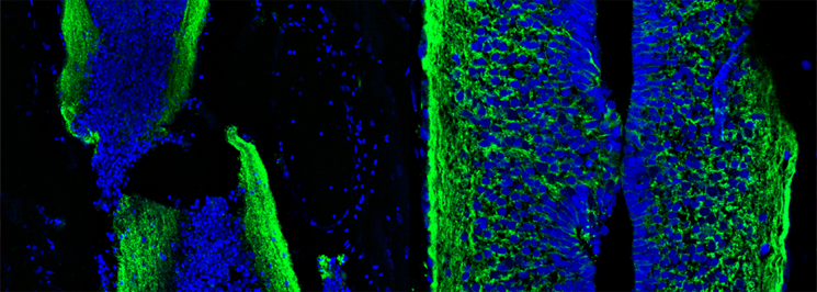 Acetylated tubulin staining at 2 (left) and 30 (right) days post transection