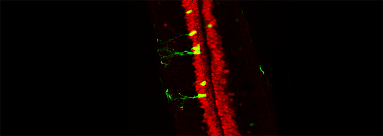 A spinal cord from a regenerative stage Xenopus tadpole stained for Sox2 (red) and electroporated with a Sox3::GFP reporter