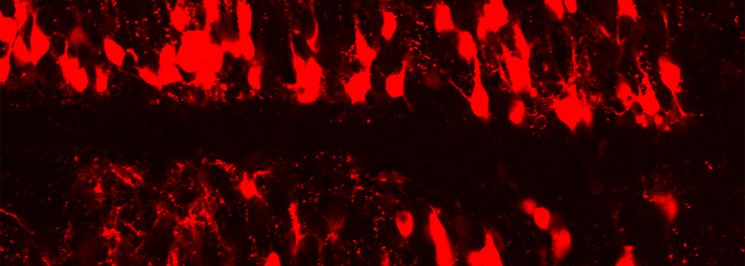 Spinal cord electroporated with antisense oligonucleotides